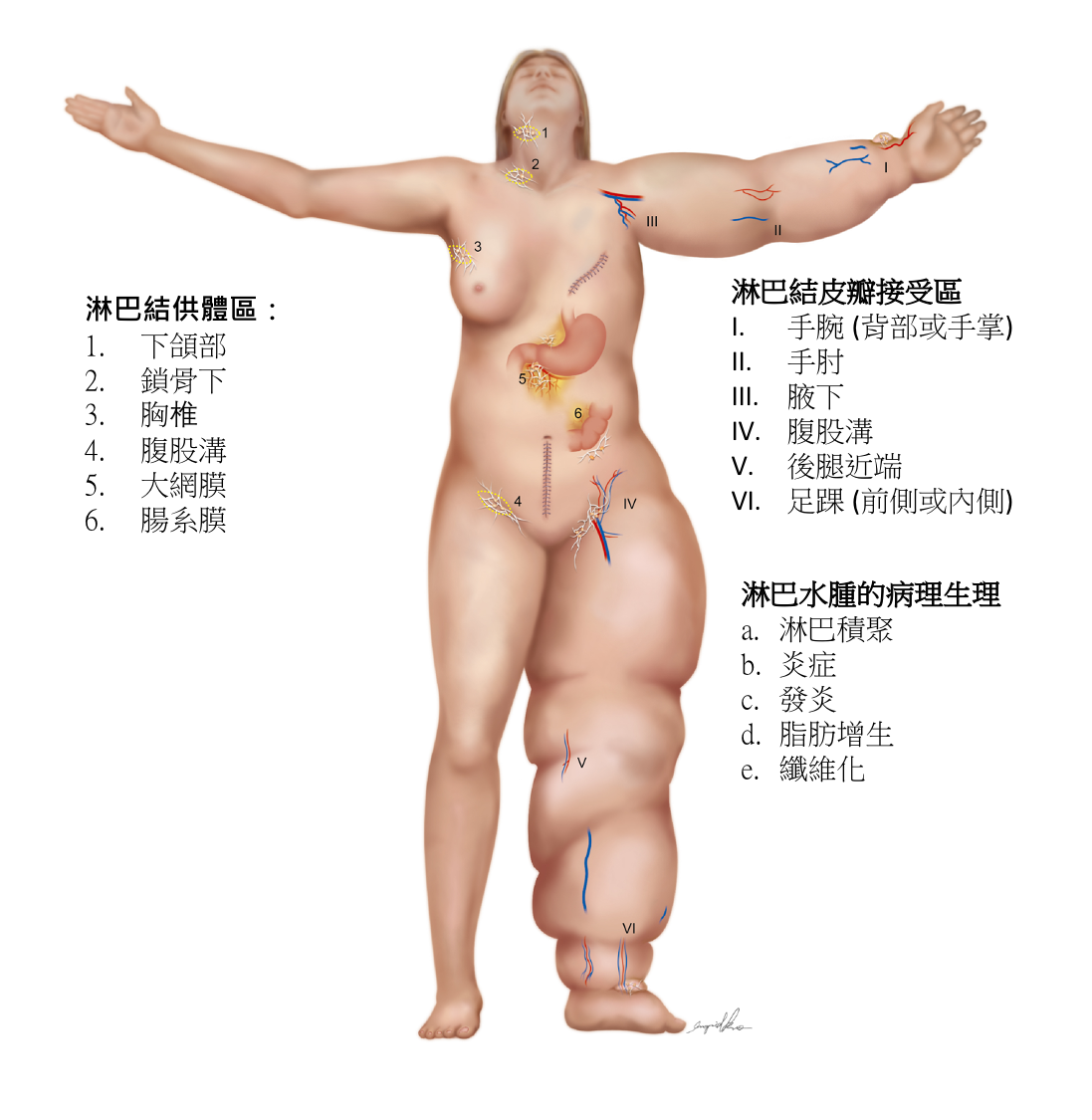 FAQS About Lymphatic System and Lymphedema - schema lymphatic system
